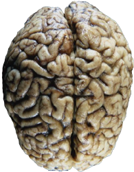 Brain left & right lobes copyright guychi.co.uk